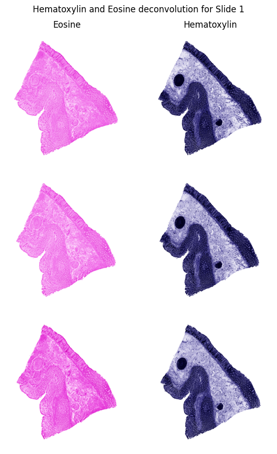 H&E Color Deconvolution
