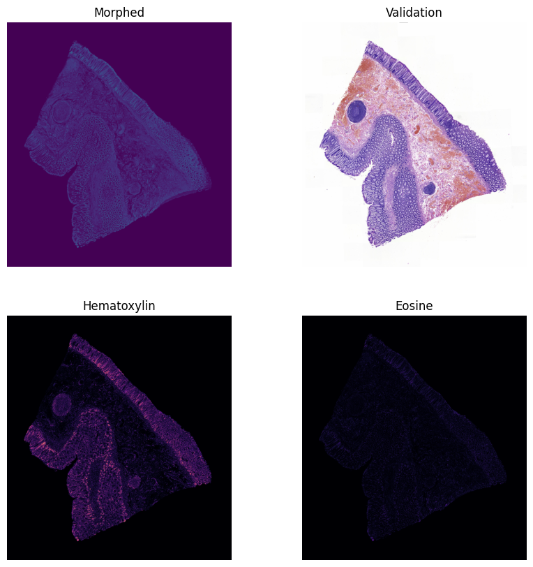 Tissue Morphing Sequence